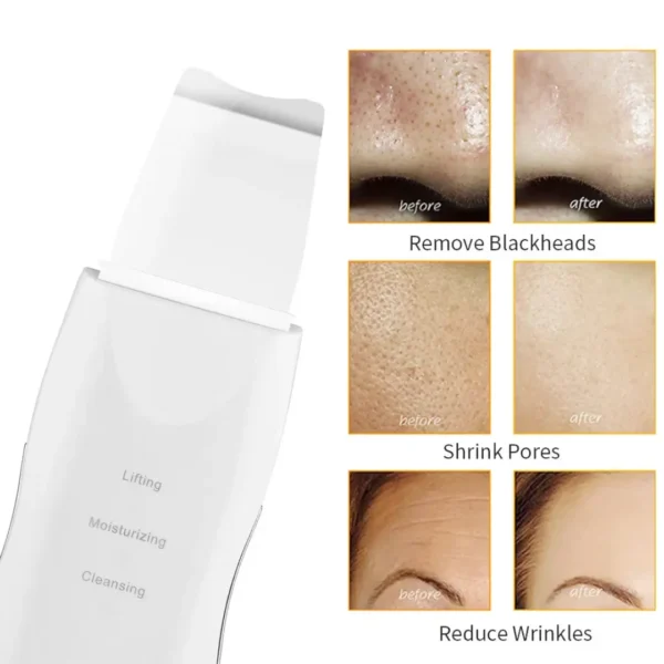 limpador Facial - Imagem 3